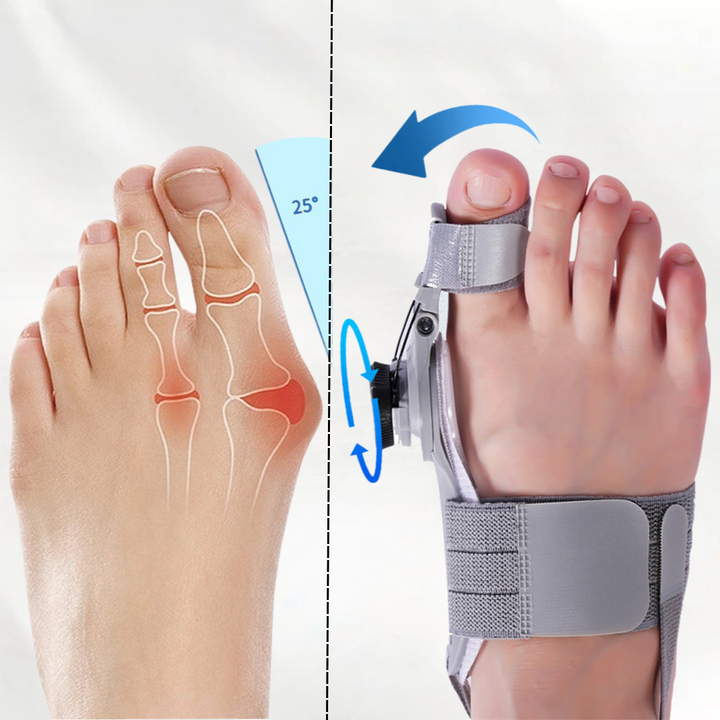 Podiance™ Bunion Fix - Natural At-Home Bunion Relief